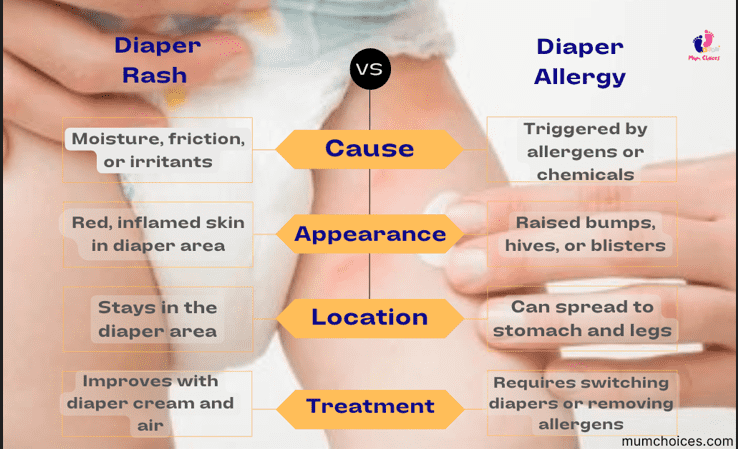 diaper allergy vs. diaper rash